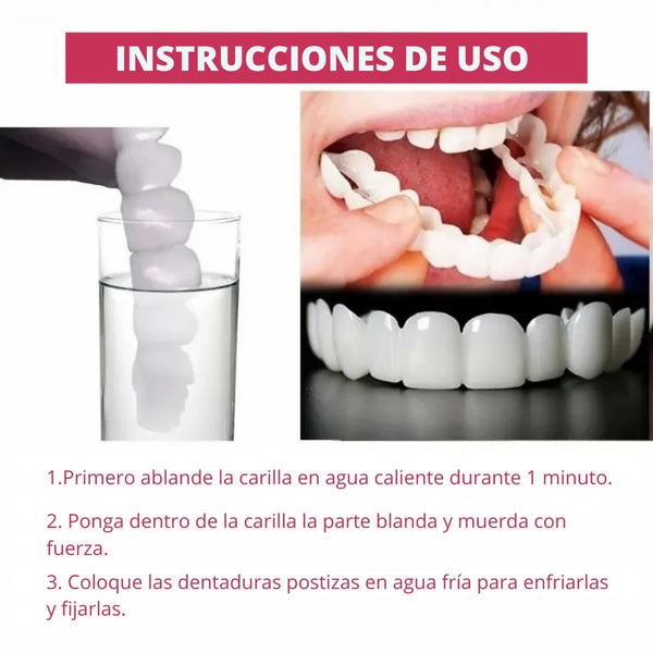 Carillas de Sonrisa Instantánea