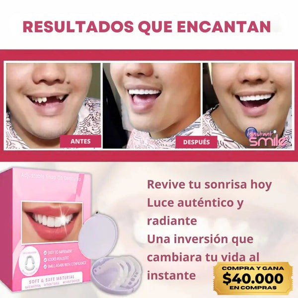 Carillas de Sonrisa Instantánea