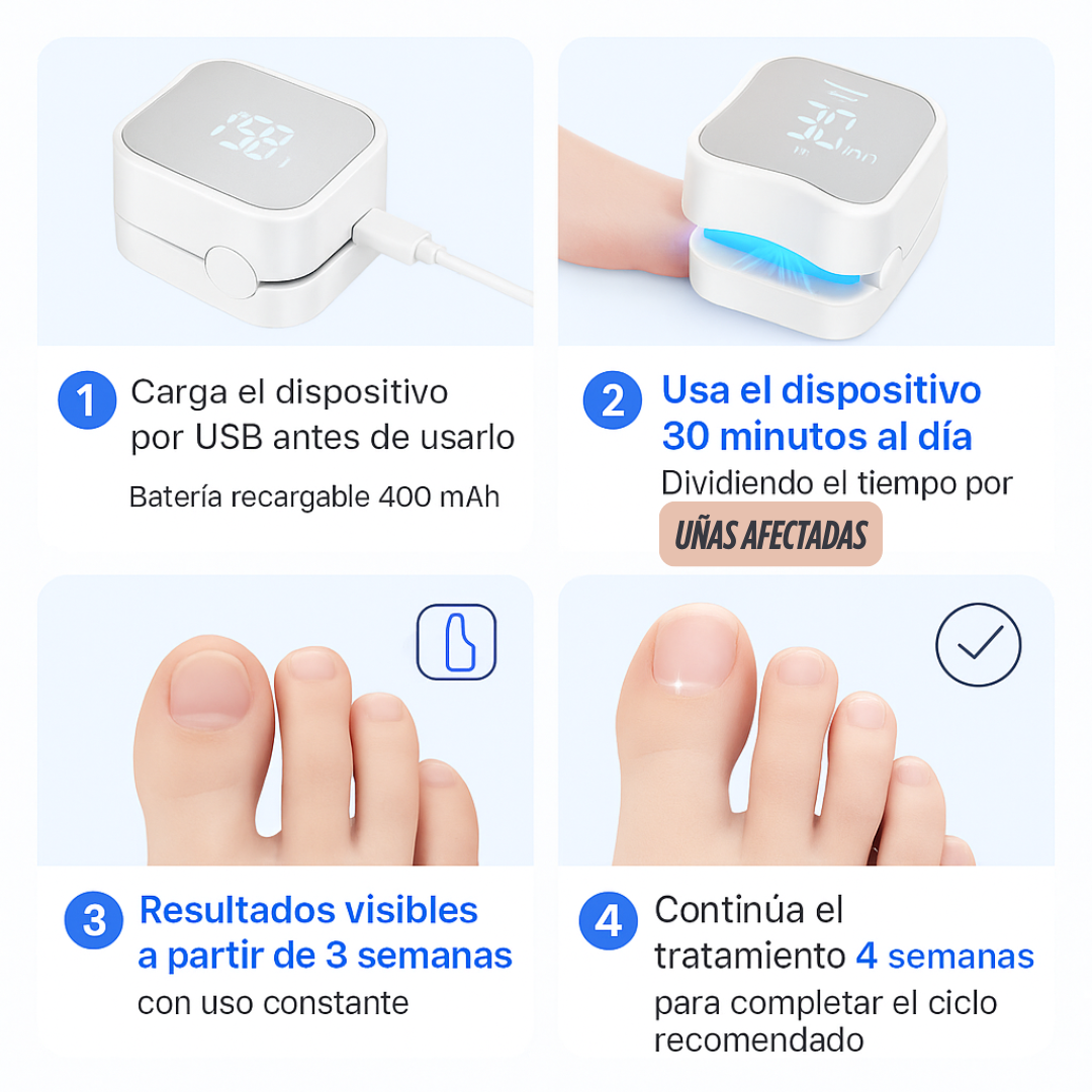 LASERNAIL PRO™ – ADIÓS A LOS HONGOS EN TIEMPO RÉCORD 💅✨