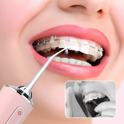 ¡IRRIGADOR PORTÁTIL 4 EN 1 HIDRODENT – SONRISA PERFECTA SIN DOLOR, SIN COSTOS Y EN TIEMPO RÉCORD! 😁