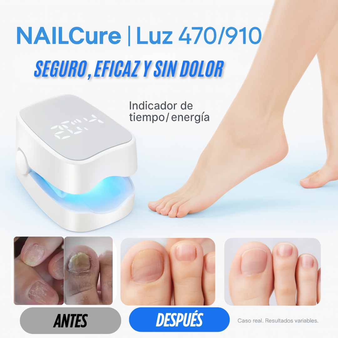 LASERNAIL PRO™ – ADIÓS A LOS HONGOS EN TIEMPO RÉCORD 💅✨